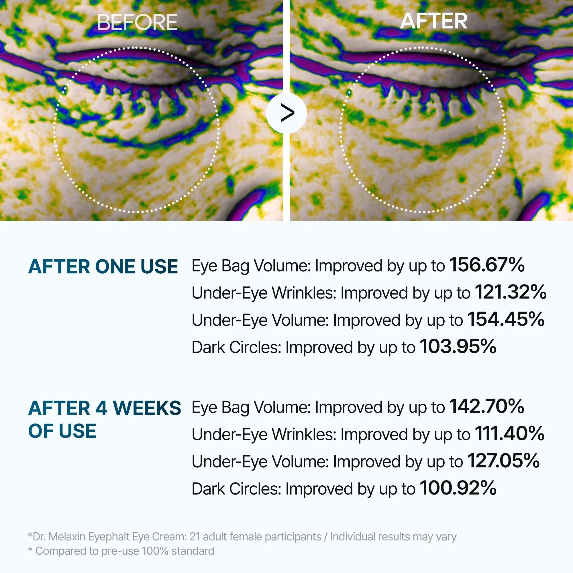 [Day&Night Care] Eyephalt Eyebag Lifting Line