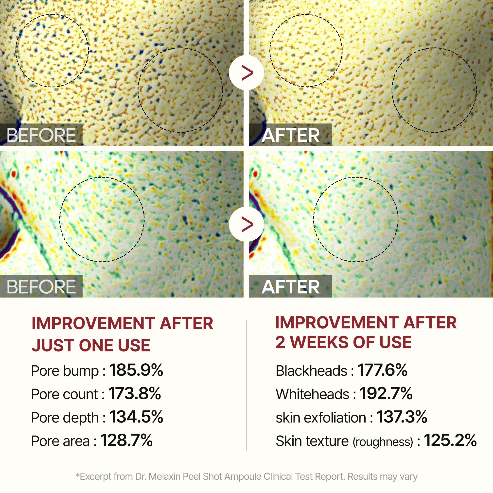 Peel Shot Glow Rice Line